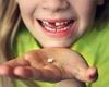 La ce vârstă se schimbă dinții de lapte? Iată ce probleme pot apărea!