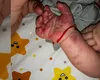 Fotografii halucinante! Un bebeluș de doar două luni a fost chinuit de către asistentele din Spitalul „Sf. Maria” din Iași. Avea fren scurt, dar s-a ales cu niște „lovituri”