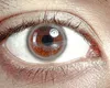 Pete gri pe albul ochiului: cauze, simptome și prevenție