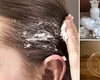 Cum să-ți faci acasă un exfoliant natural pentru scalp. Ajută la o creștere sănătoasă a părului!