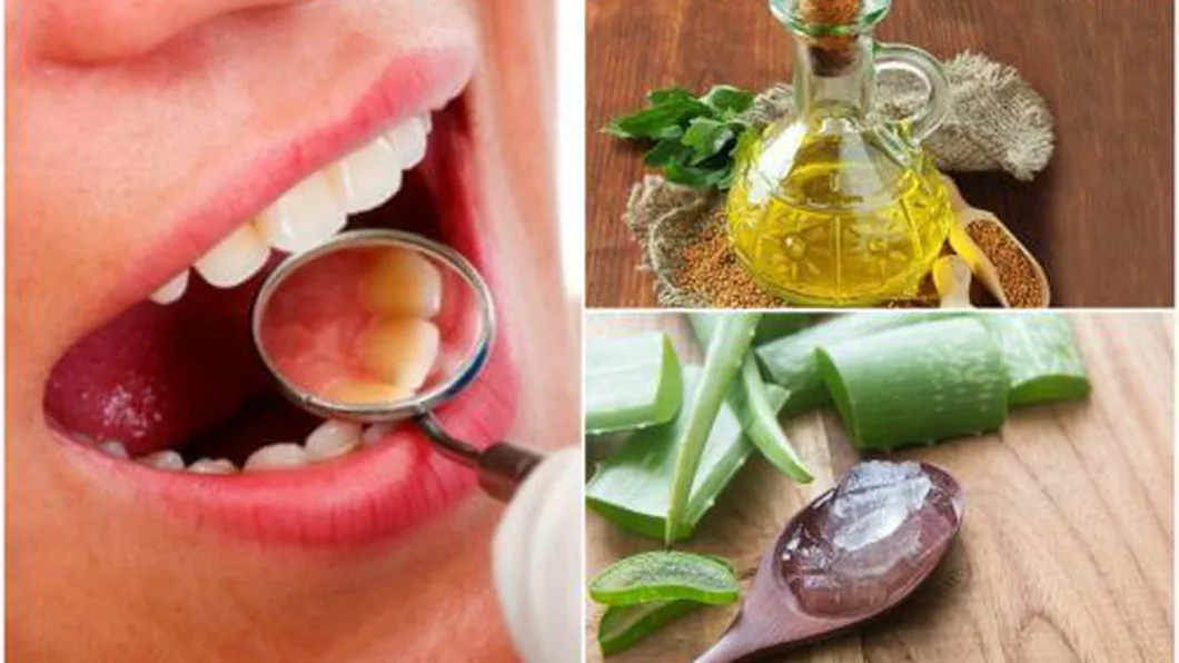 6 remedii naturale pentru indepartarea tartrului dentar
