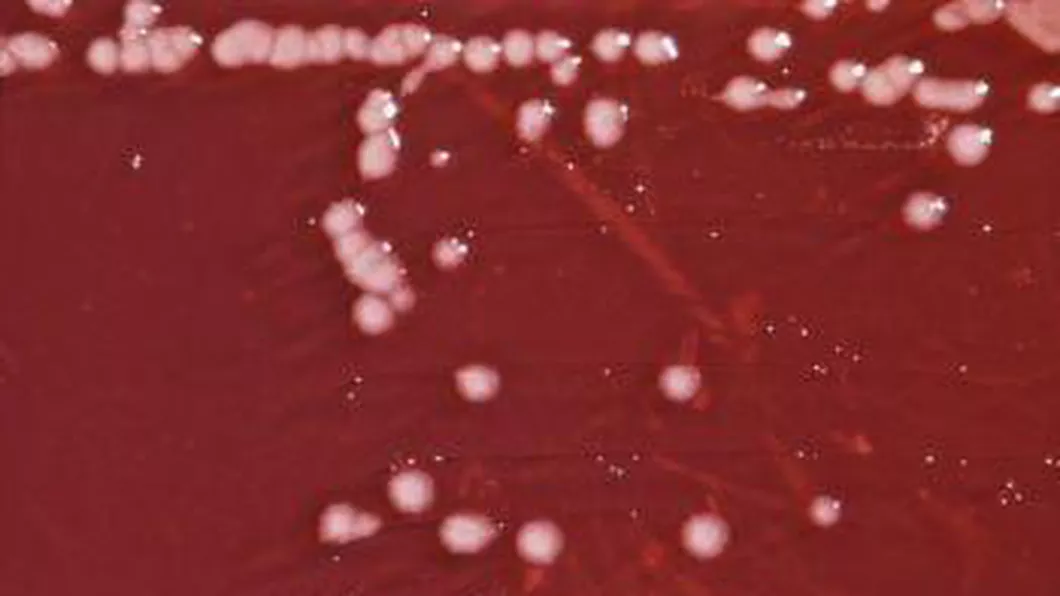 Pseudomonas bacteria care ucide