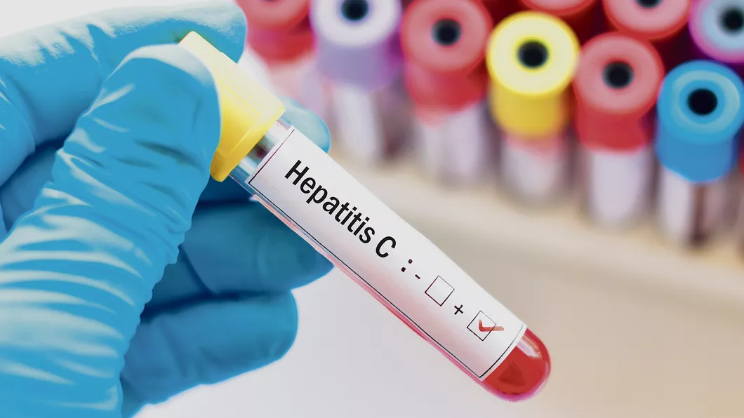 Hepatita C în 5 întrebări