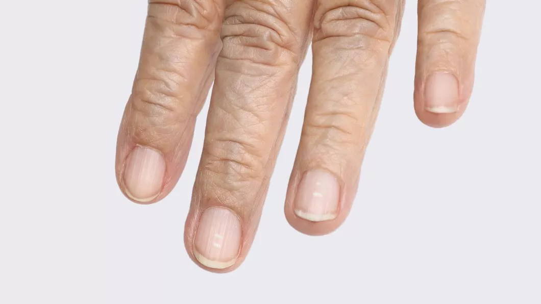 8 probleme de sănătate dezvăluite de unghiile tale