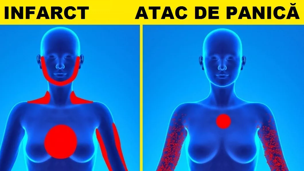 Cum faci diferența dintre un atac de panică și un atac de cord