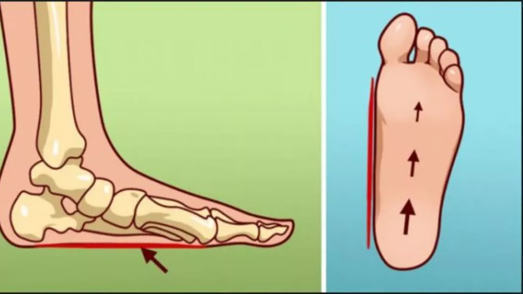 Cele mai frecvente cauze ale durerii piciorului