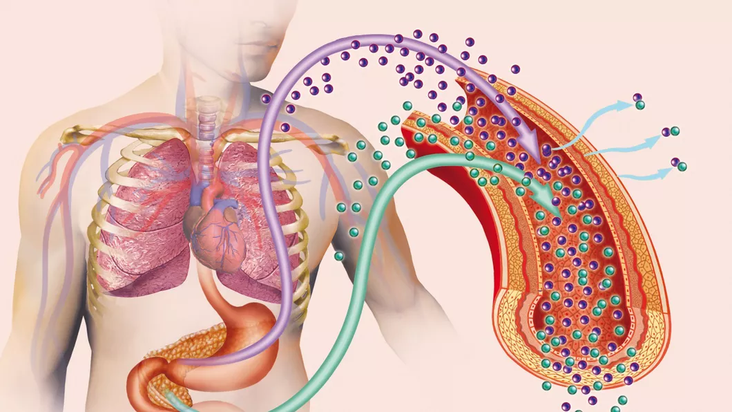 Diabetul un precursor al cancerului pancreatic