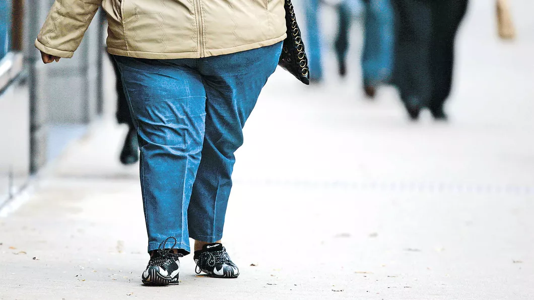 Obezitatea este o formă de îmbătrânire prematură