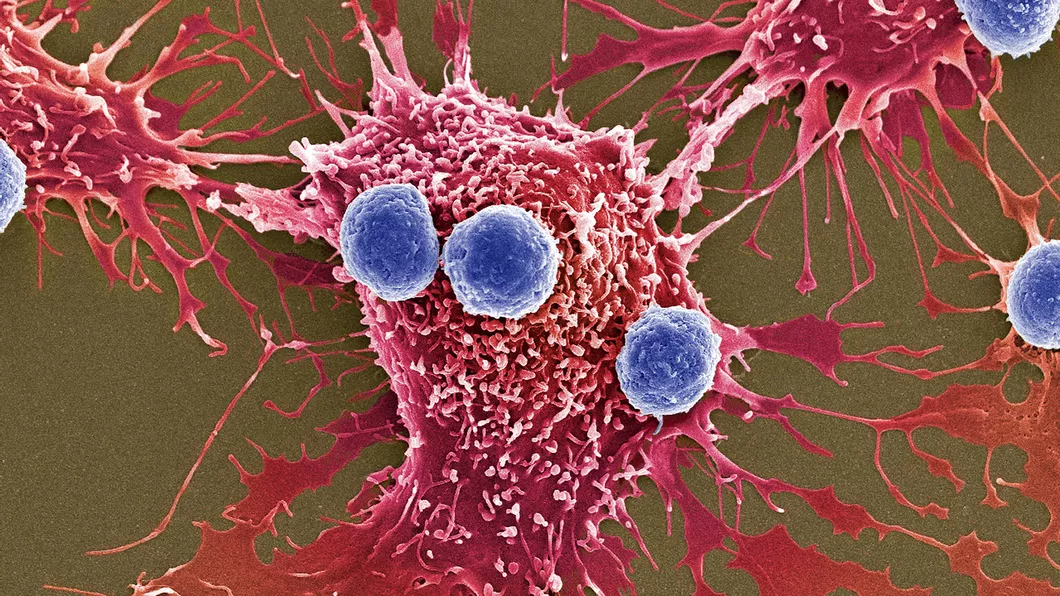 Peste 50 de tipuri de cancer pot fi depistate cu ajutorul unui simplu test de sânge