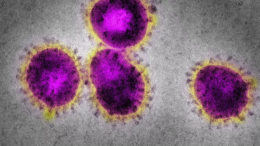 Cazul 37 de coronavirus este confirmat în România