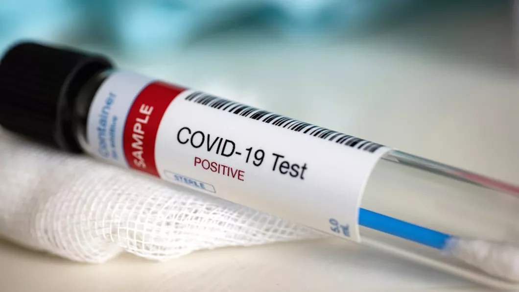 Veşti bune pentru cadrele medicale testate ieri pentru COVID-19