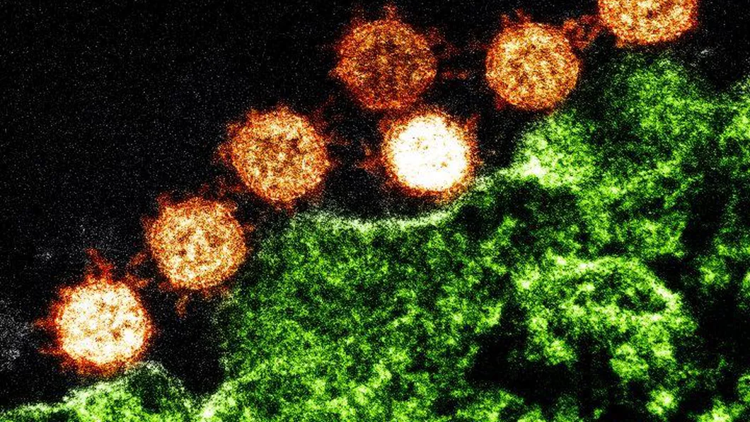Încă trei persoane de coronavirus Un bărbat a murit pe 5 aprilie și a fost raportat de-abia astăzi