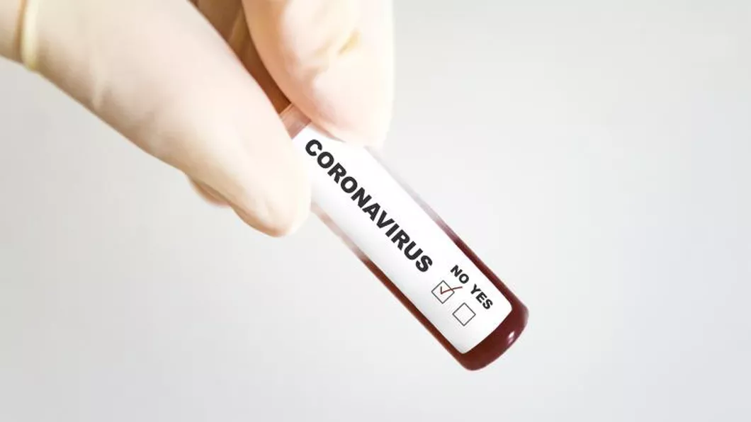 O linie a unei companii a fost închisă după ce 32 de muncitori au fost testați pozitiv cu noul coronavirus