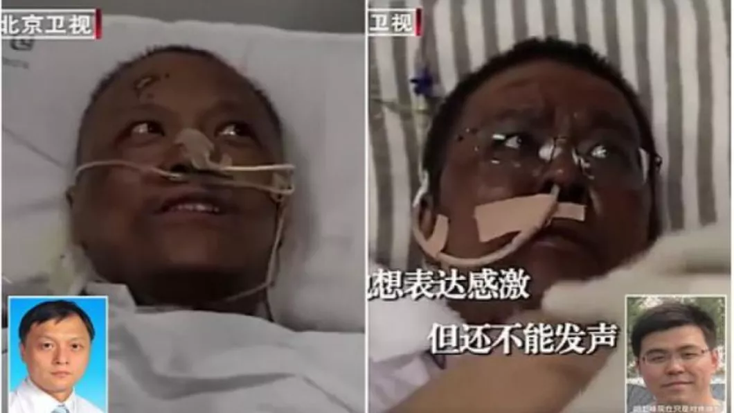 A murit unul din medicii chinezi a căror piele s-a înnegrit din cauza tratamentului pentru Covid-19