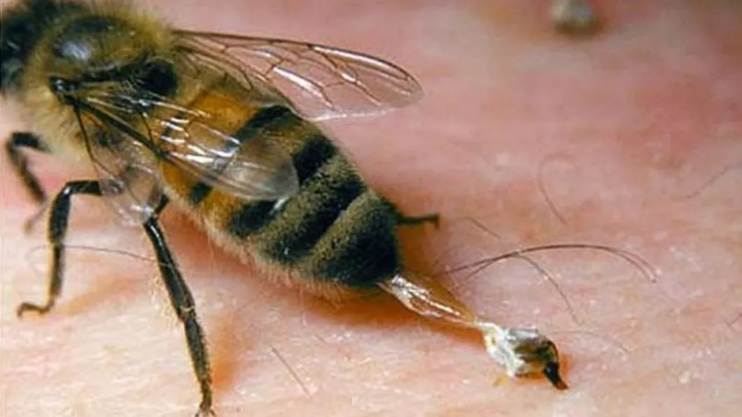 Cum tratezi înțepătura de albină cu remedii naturiste. Ce trebuie să faci în cazul unei reacții alergice severe