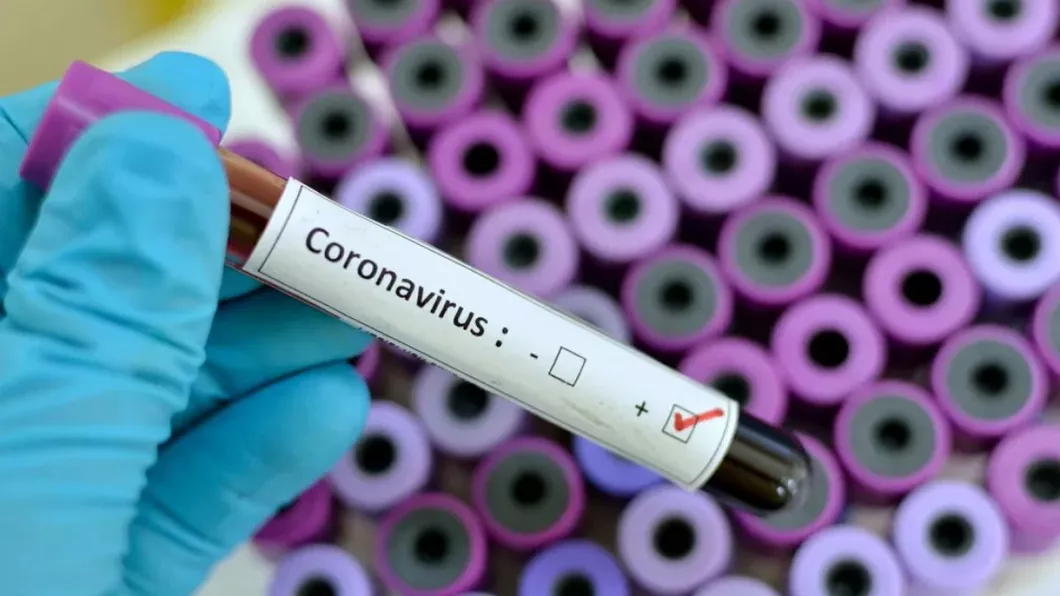 OMS raportează un record al infectărilor Noile cazuri de coronavirus ajung la valori maxime