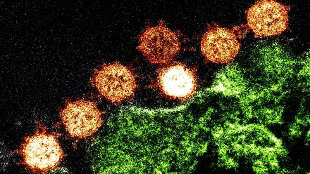Furtunile de citokine impiedica un răspuns imun durabil la COVID-19