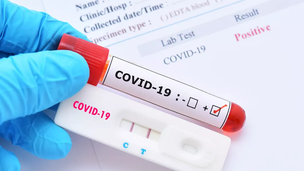 Raportarea testelor rapide COVID devine obligatorie de luni
