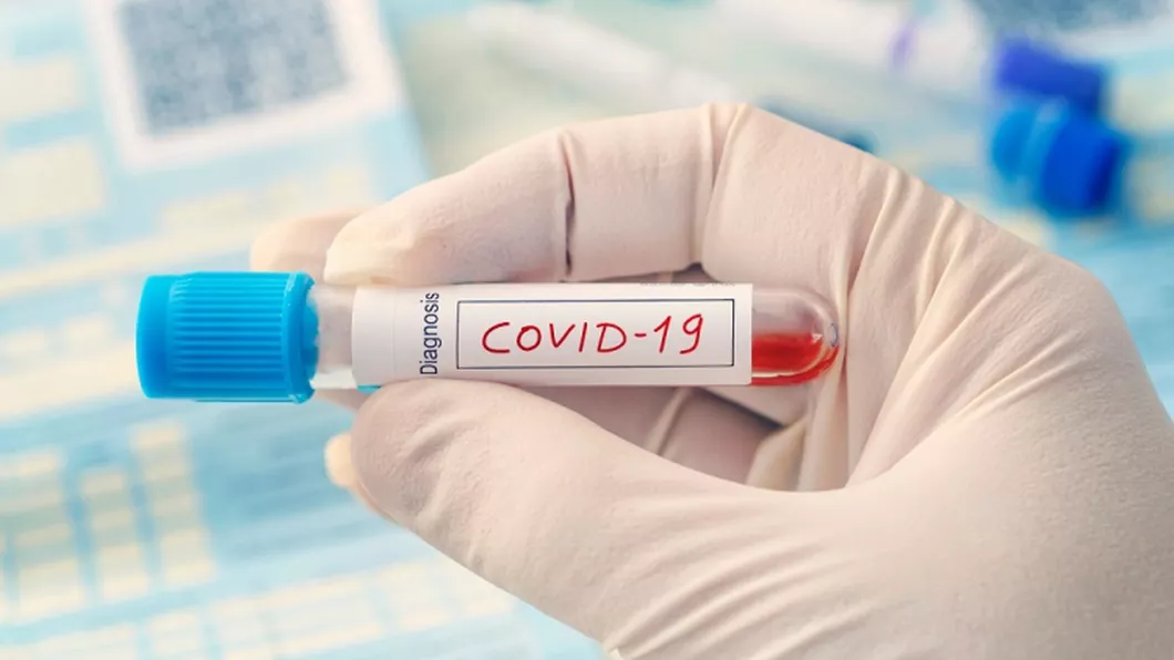 Prețul unui test Covid-19 la clinicile din România