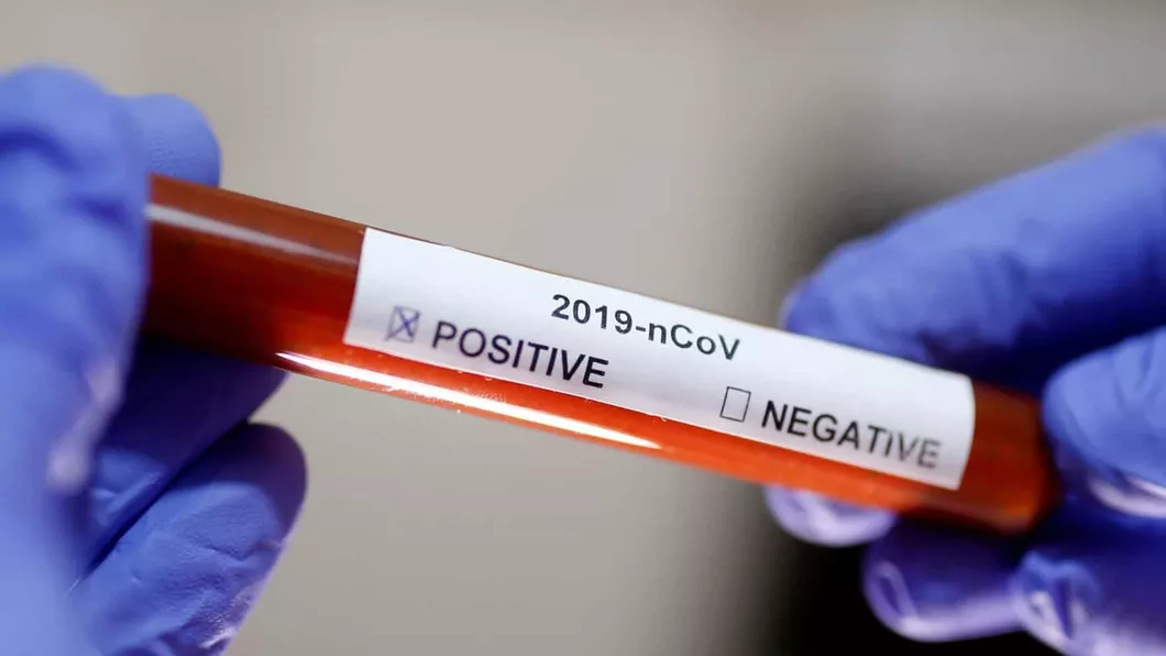 Cercetătorii din Hong Kong spun că au documentat primul caz de reinfectare cu coronavirus la peste 4 luni de la contaminarea inițială