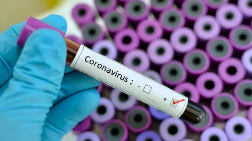 Doar 930 cazuri noi de persoane infectate cu COVID-19 în ultimele 24 de ore în România