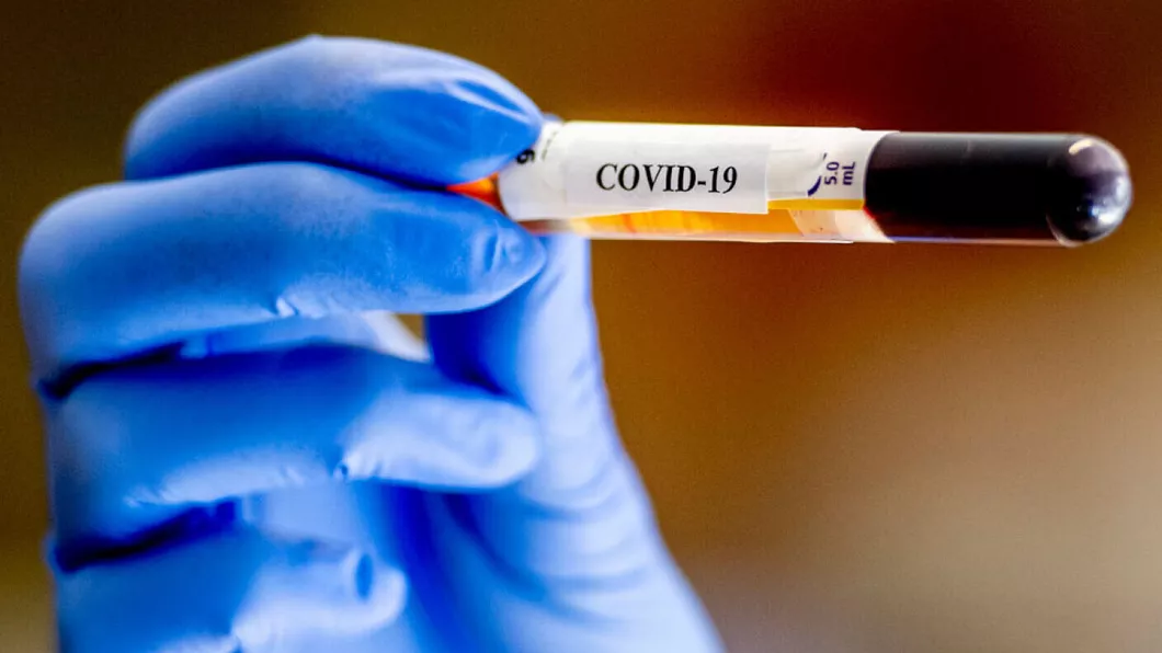 Numărul cazurilor de Covid-19 a depășit 50 de milioane la nivel mondial