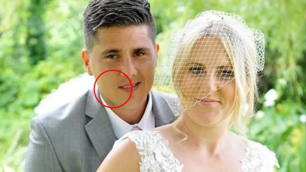 Un detaliu terifiant din fotografia de la nuntă i-a dezvăluit unei femei că soțul ei are cancer