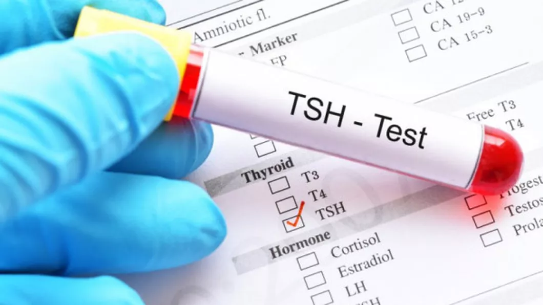 Ce înseamnă TSH mic Cauze simptome și valori normale