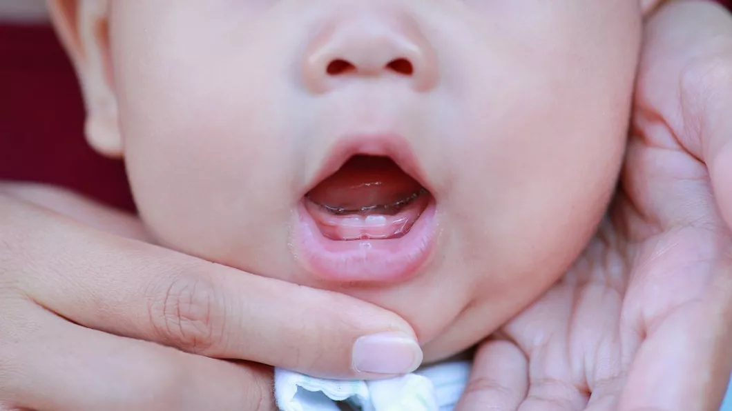 În cât timp erupe un dinte la bebeluși Principalele metode pentru ameliorarea durerilor