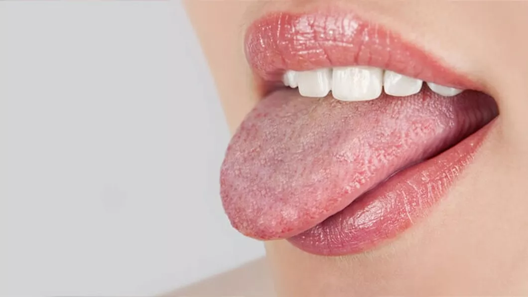 Tratament cu bicarbonat de sodiu pentru candida bucală Iată cum se prepară
