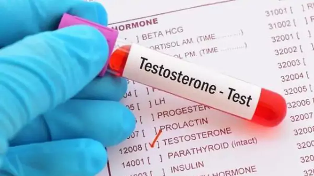 Specialiştii de la Bodyline explică ce este Testosteronul hormon pe care îl găsim atât la bărbați cât și la femei
