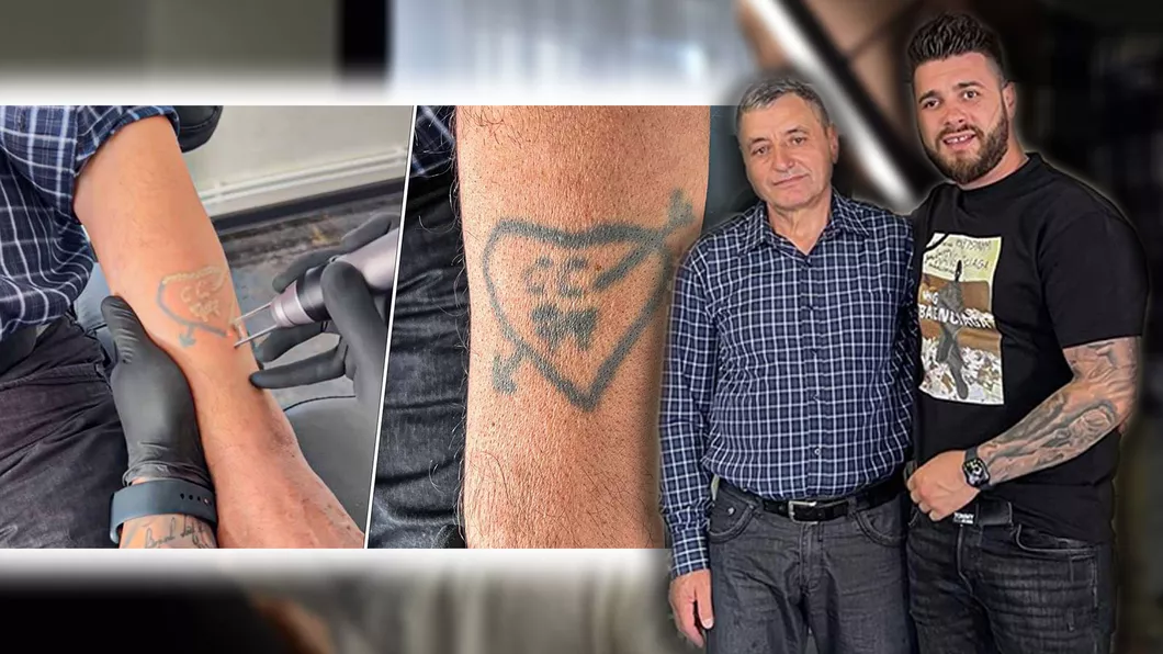 Tatuaj vechi de 50 de ani îndepărtat la un salon din Iași Care este povestea din spatele greșelii de la 15 ani  VIDEO