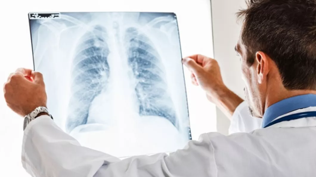 Ce este edemul pulmonar acut Cum se manifestă afecțiunea și care este cel mai bun tratament