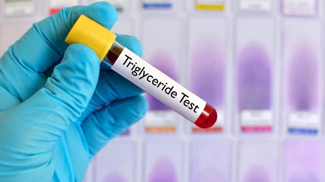 Trigliceride serice mărite. Ce boli grave semnalează acest diagnostic