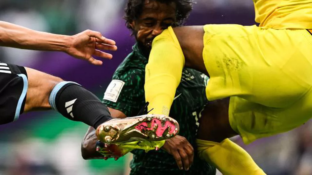 Tragedie la Campionatul Mondial. Așa arată radiografia jucătorului accidentat în meciul Argentina-Arabia Saudită - VIDEOFOTO