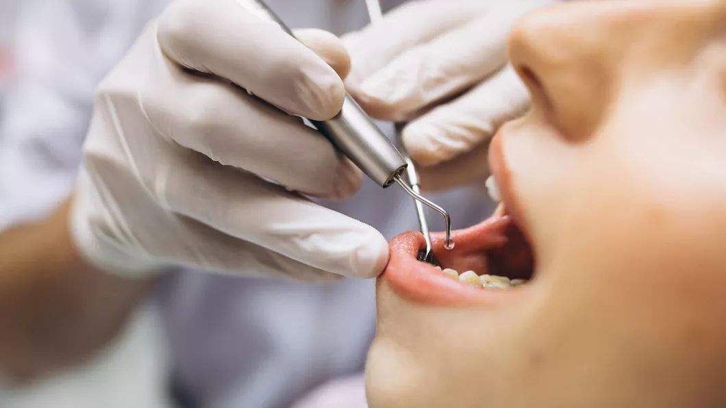 Detartrajul sensibilizează dinții Explicația medicului Andreea Daniela Alexe - VIDEO