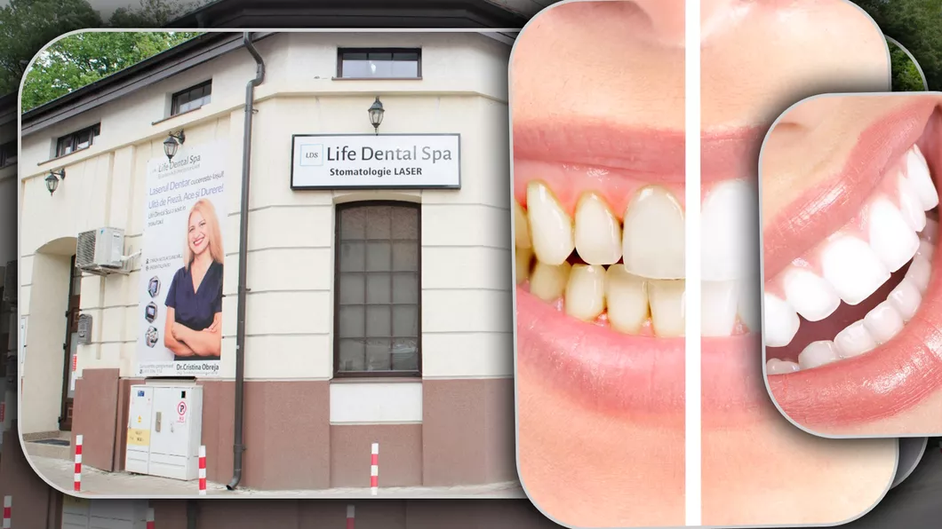 Ajutor pentru elevi și studenți. Până pe data de 11 septembrie Life Dental Spa oferă reduceri considerabile la serviciile stomatologice