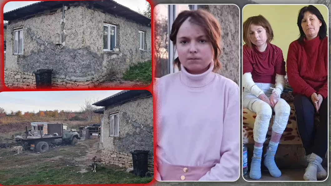 Apel umanitar pentru o tânără din Iași diagnosticată cu epidermoliză buloasă - FOTO