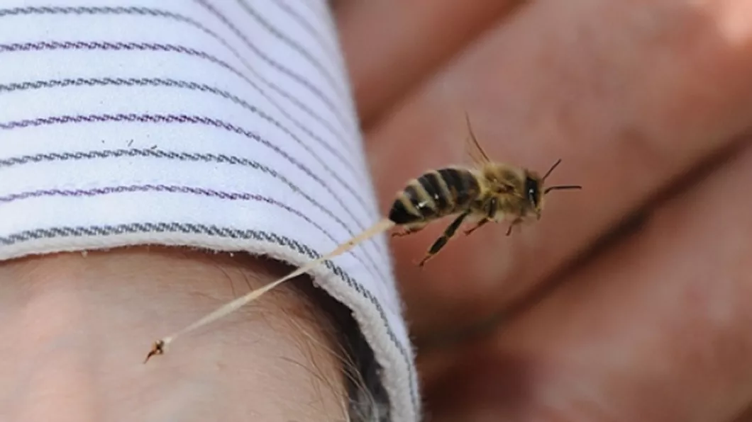 7 tipuri de intepaturi de insecte. Vezi care sunt efectele si cateva leacuri naturiste