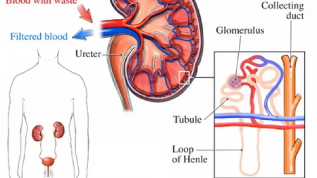 Tipuri de glomerulonefrita