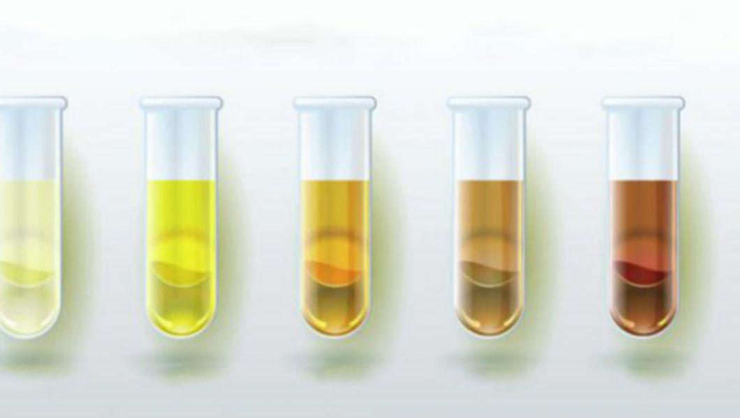 culoarea urinei prostatitei cronice