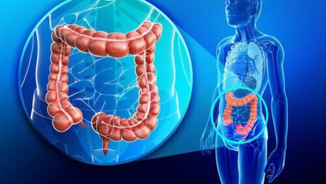 dureri articulare în boala Crohn
