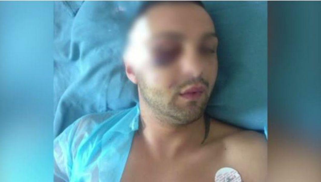 Luptator De Kickboxing Din Timisoara Batut De Necunoscuti Pe Strada Chiar In Fata Iubitei Bzi Ro