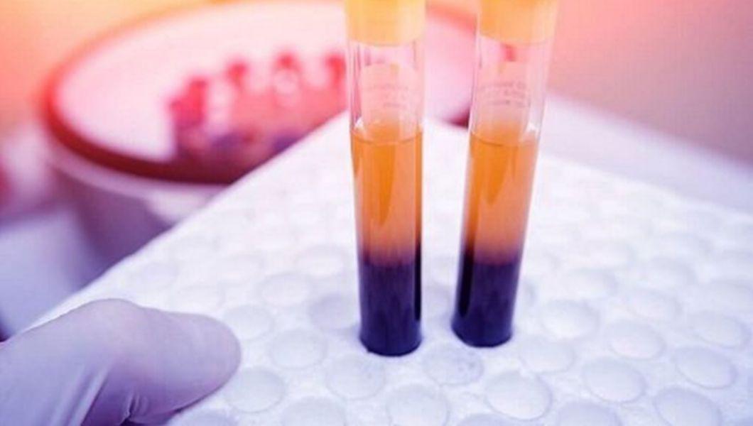 4 Remedii Ce Ajuta La Cresterea Numarului De Trombocite Buna Ziua Iasi Bzi Ro