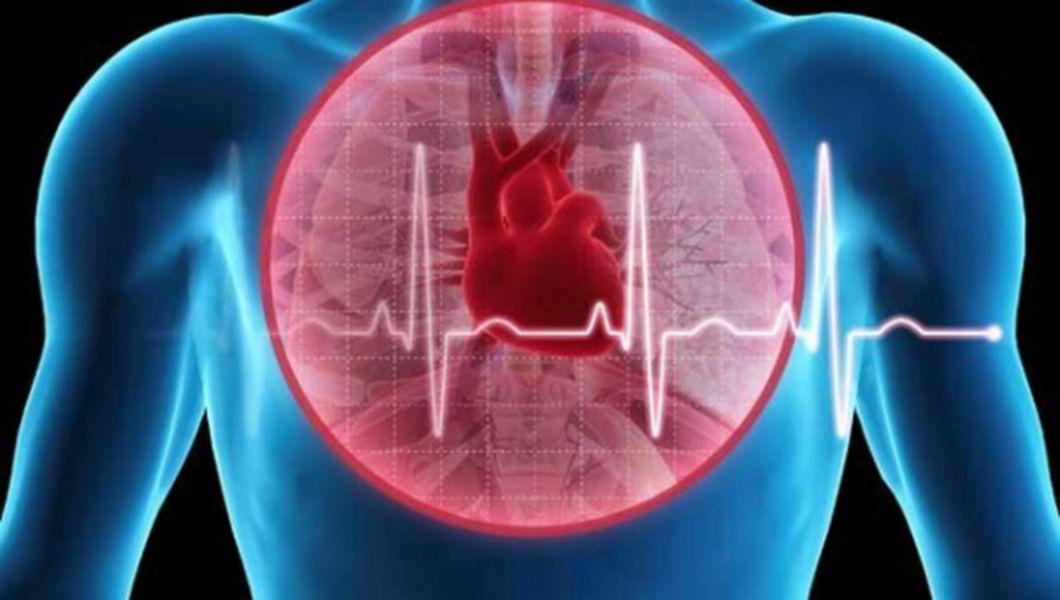 Infarctul Momentul In Care O Parte Din Inima Moare Care Sunt Semnele Si Cand E Necesara Operatia Buna Ziua Iasi Bzi Ro