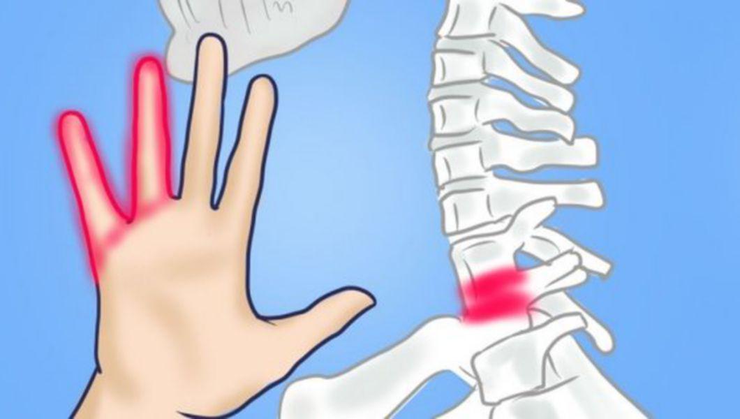 Sindromul de tunel carpian – amortirea frecventa a mainilor - Farmacia Alphega