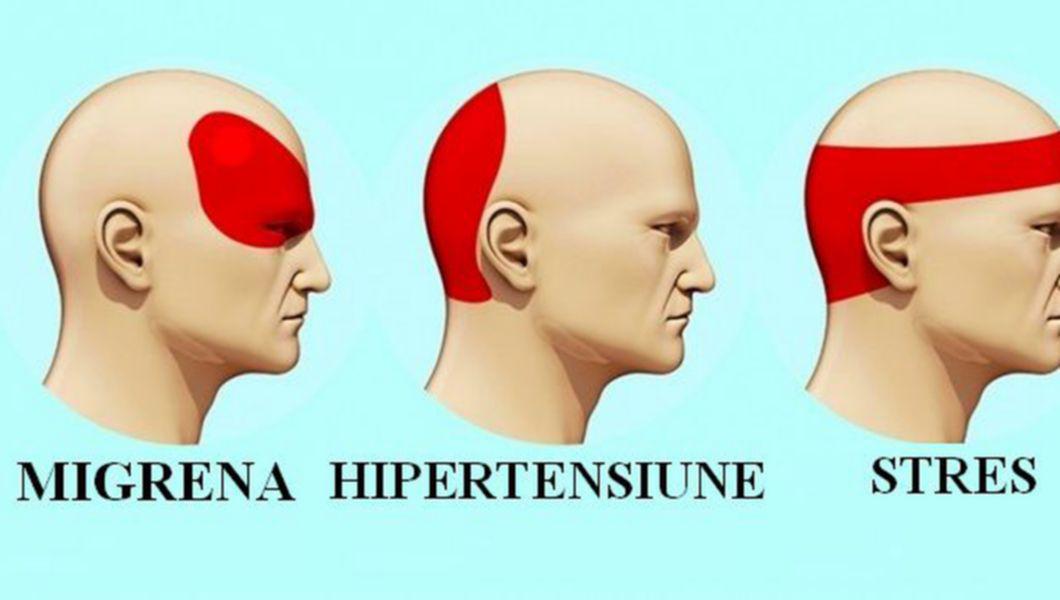 Cum Sa Scapi De Durerea De Cap In 5 Minute Fara Sa Inghiti Pastile Buna Ziua Iasi Bzi Ro
