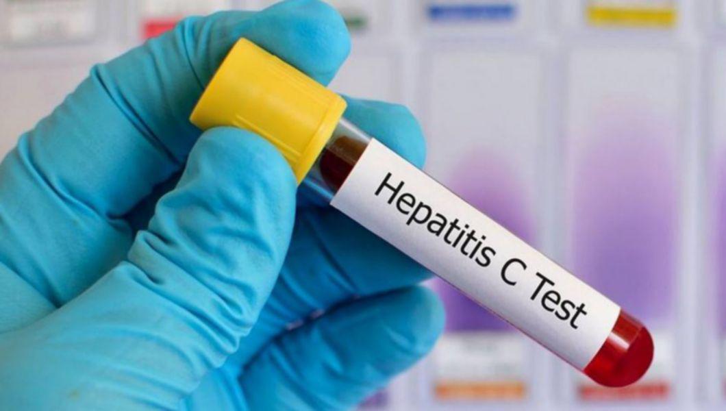 Cum Se Transmite Hepatita C Contactul Cu Sangele Infectat