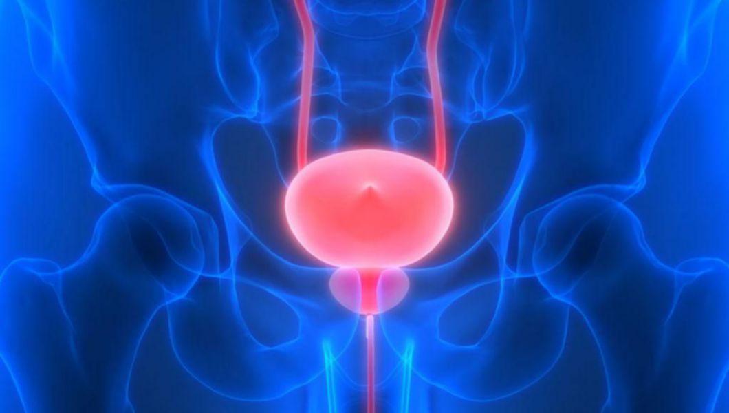🏥 Spasmele vezicii urinare: tratamentul, cauzele și alte 