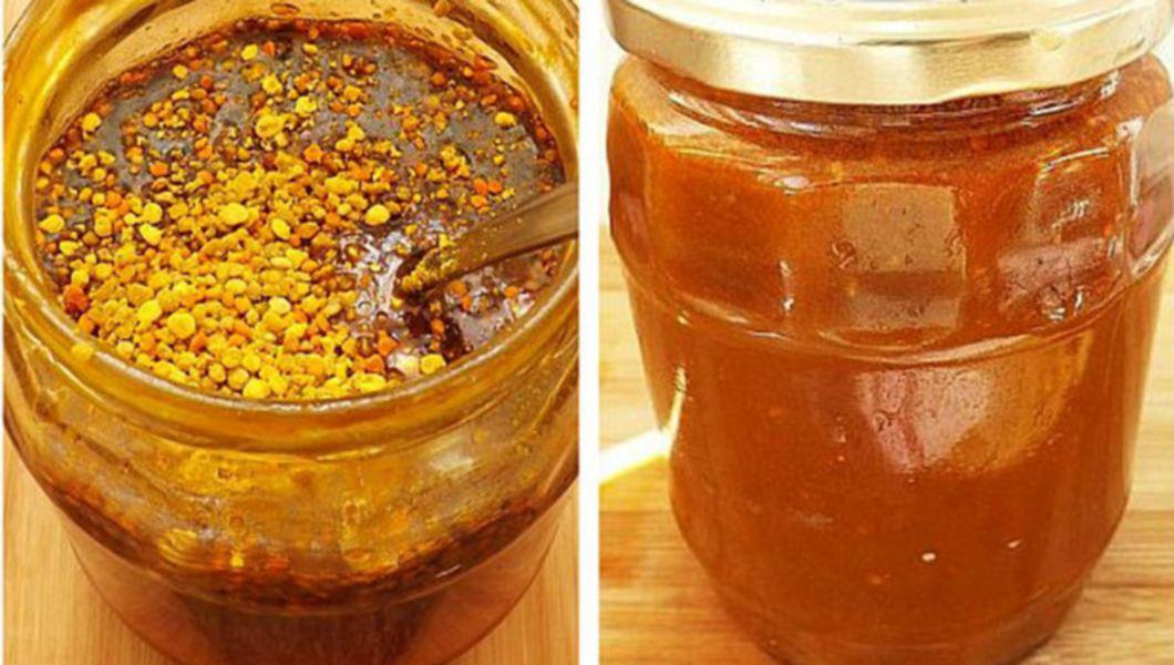 Tratarea varicelor cu miere și usturoi
